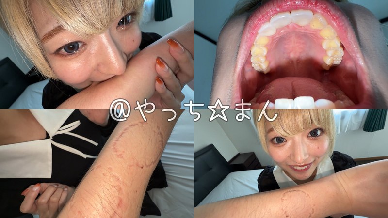 【お姉さん噛みつき】虫歯ゼロの綺麗な歯並びで腕にガッツリ噛み跡